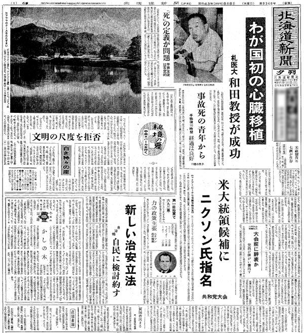 札幌アーカイブス1922－2022＞⑥ 札医大 国内初の心臓移植（１９６８年８月８日）：北海道新聞デジタル