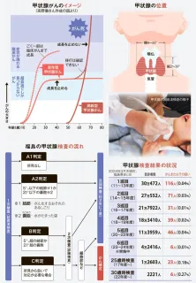 福島で多発する子どもの甲状腺がん 原発事故から14年 声を上げ